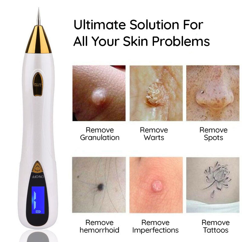 Remover Pen™ for Moles