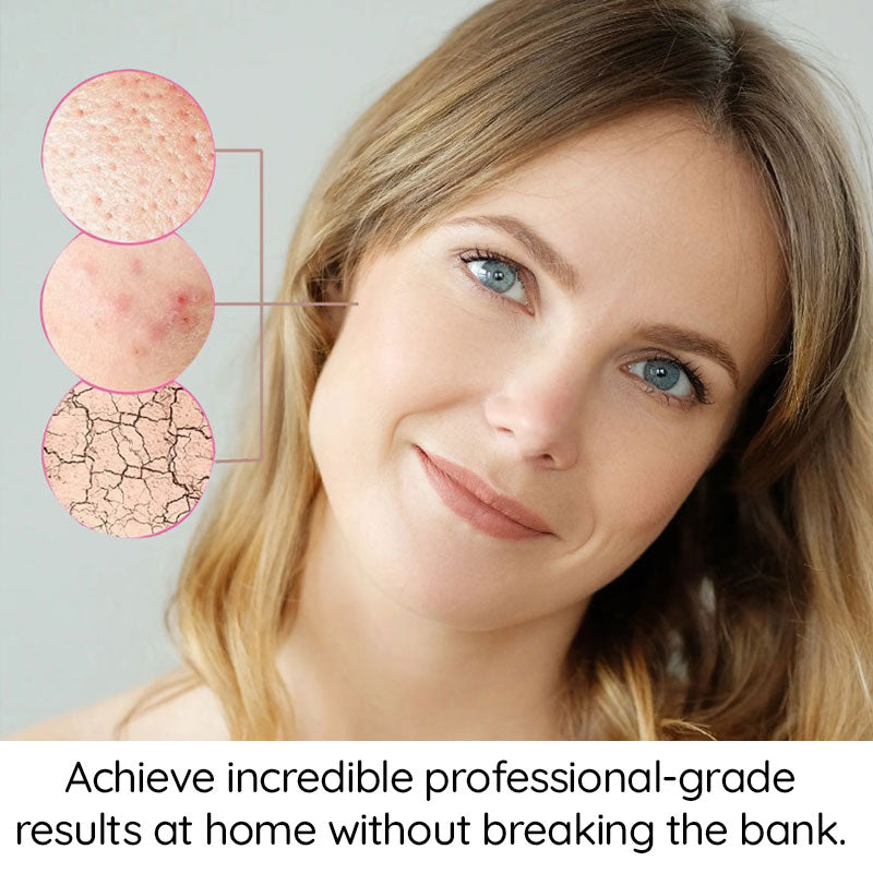 Remover Pen™ for Moles