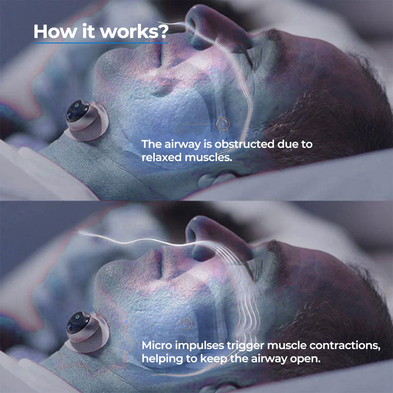 NEW Smart Anti Snore Device