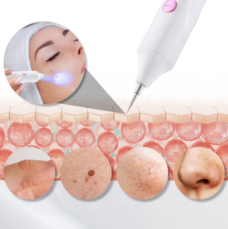 Premium Mole Remover Pen
